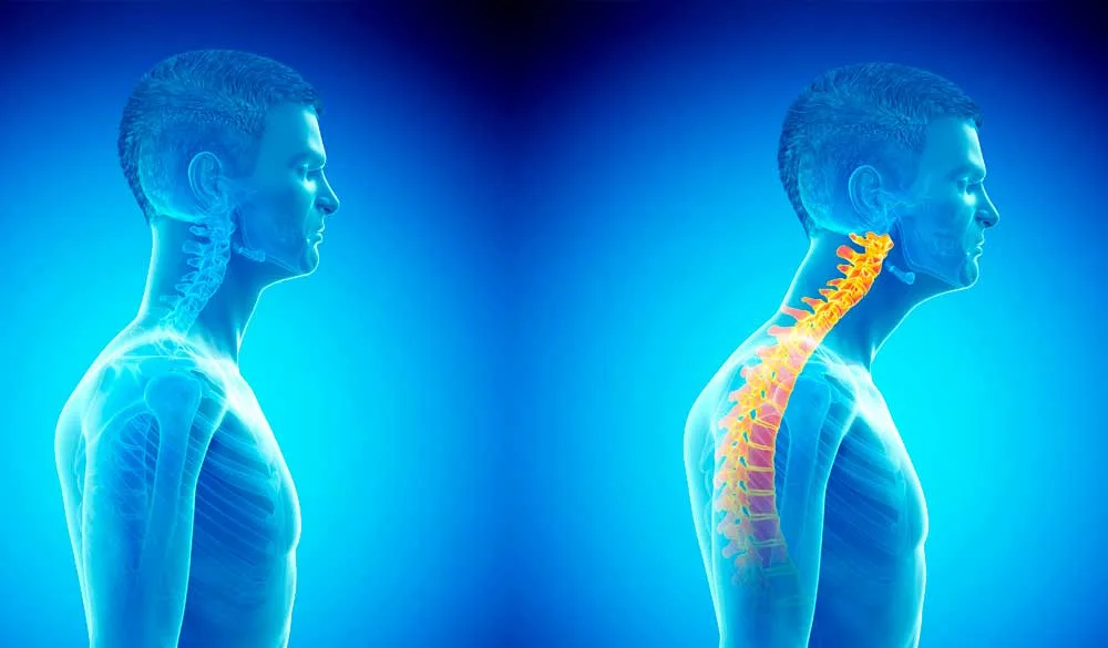 Forward Head Posture - mouth and jaw