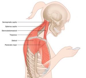 Headaches & Muscle Tension in Your Upper Shoulders & Neck?