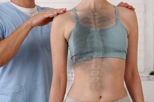 Scoliosis Facts - Scoliosis Facts