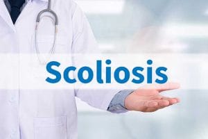 Understanding Scoliosis and Goals of Care - Understanding Scoliosis and Goals of Care