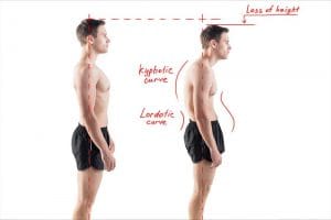 Three Major Types of Rehabilitation for Spinal Conditions Used by Structural Correction Chiropractors - Structural Correction Chiropractors