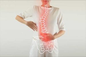 Tratamiento de la escoliosis sin corsé ni cirugía - tratamiento de la escoliosis sin corsé ni cirugía