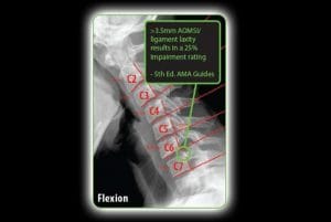 What Makes Structural Correction Chiropractic Different Than Other Healthcare Protocols and Treatments? . The optimal global and segmental shape of the human spinal structure is designed to resist this ongoing relentless downward force and distribute its body weight symmetrically around this vertical axis of gravity