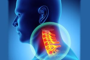 Incidence of cervical kyphosis and cervical posterior translation in neck pain associated with radiological evidence of degenerative disc disease. Cervical kyphosis was present in 60% of patients with radiologically evident degenerative disc disease, with C5 showing the most posterior displacement.